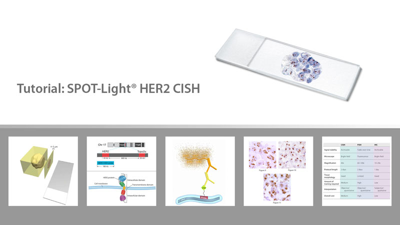 Tutorial: SPOT-Light鐃緒申鐃� HER2 CISH